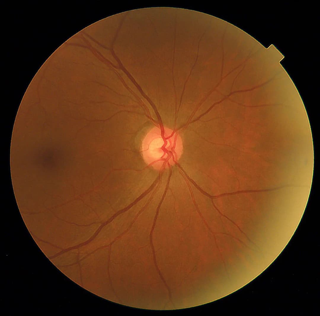 MyDr Detection